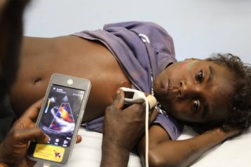 شخیص روماتیسم قلبی با ابزارهای پزشکی