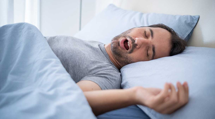 انحراف بینی؛ هرآنچه باید بدانید_سمسون 9 ارتباط انحراف بینی و آپنه خواب