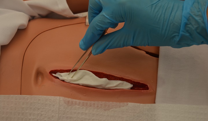 راهنمای عمل آپاندیس: از عوارض سپس از عمل آپاندیس تا حالت تهوع سپس از عمل آپاندیس_سمسون 13 مراقبتهای بعد از عمل آپاندیس - پانسمان زخم باز