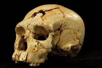 جمجمه نئاندرتالی ممکن است علت سردرد برخی افراد را توضیح دهد